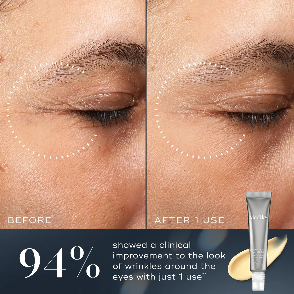 Medik8 Crystal Retinal Ceramide Eye 10 15ml