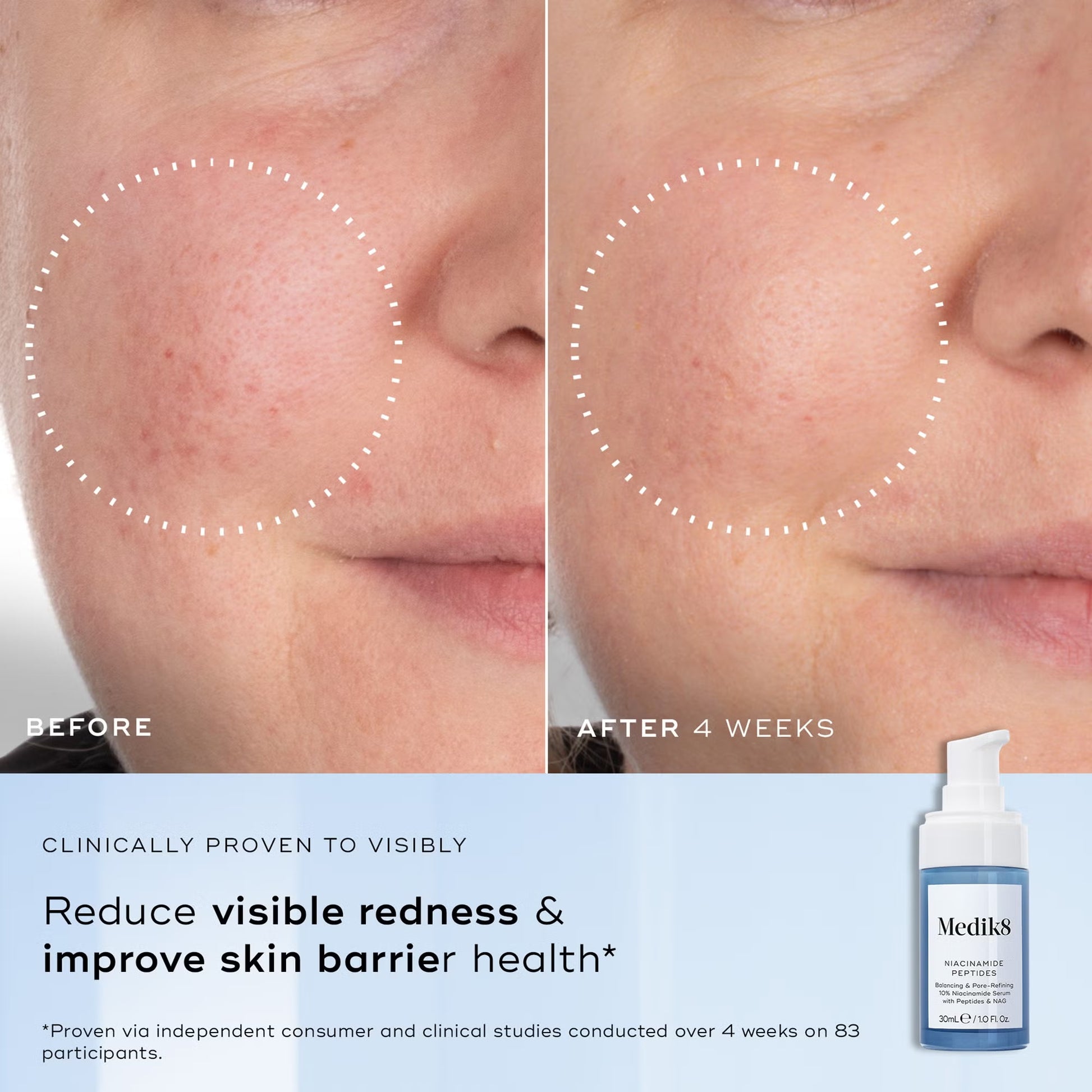 Medik8 Niacinamide Peptides 30ml