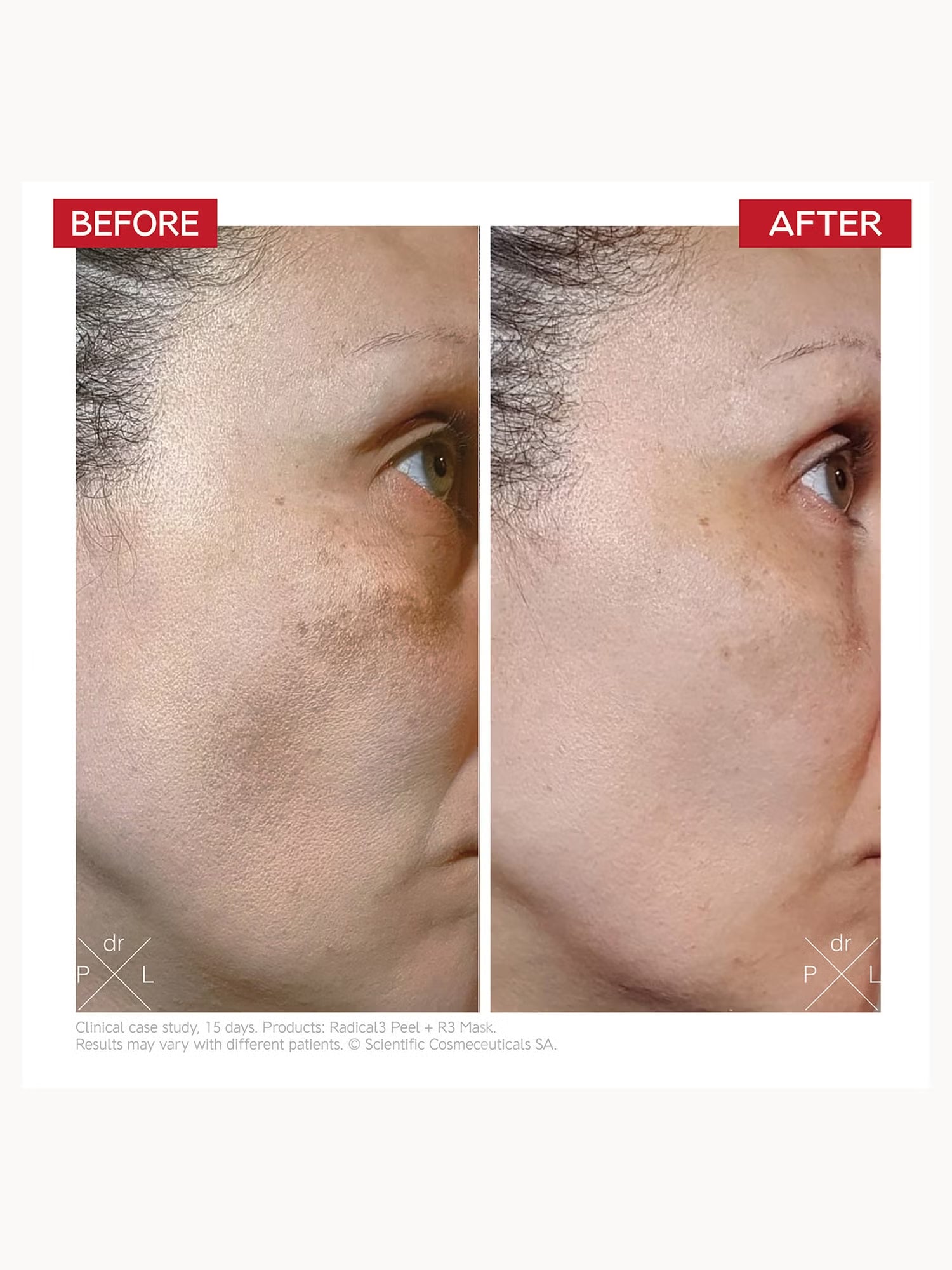 Dr. LEVY Switzerland Radical3 Reboot Pro Peel 50ml