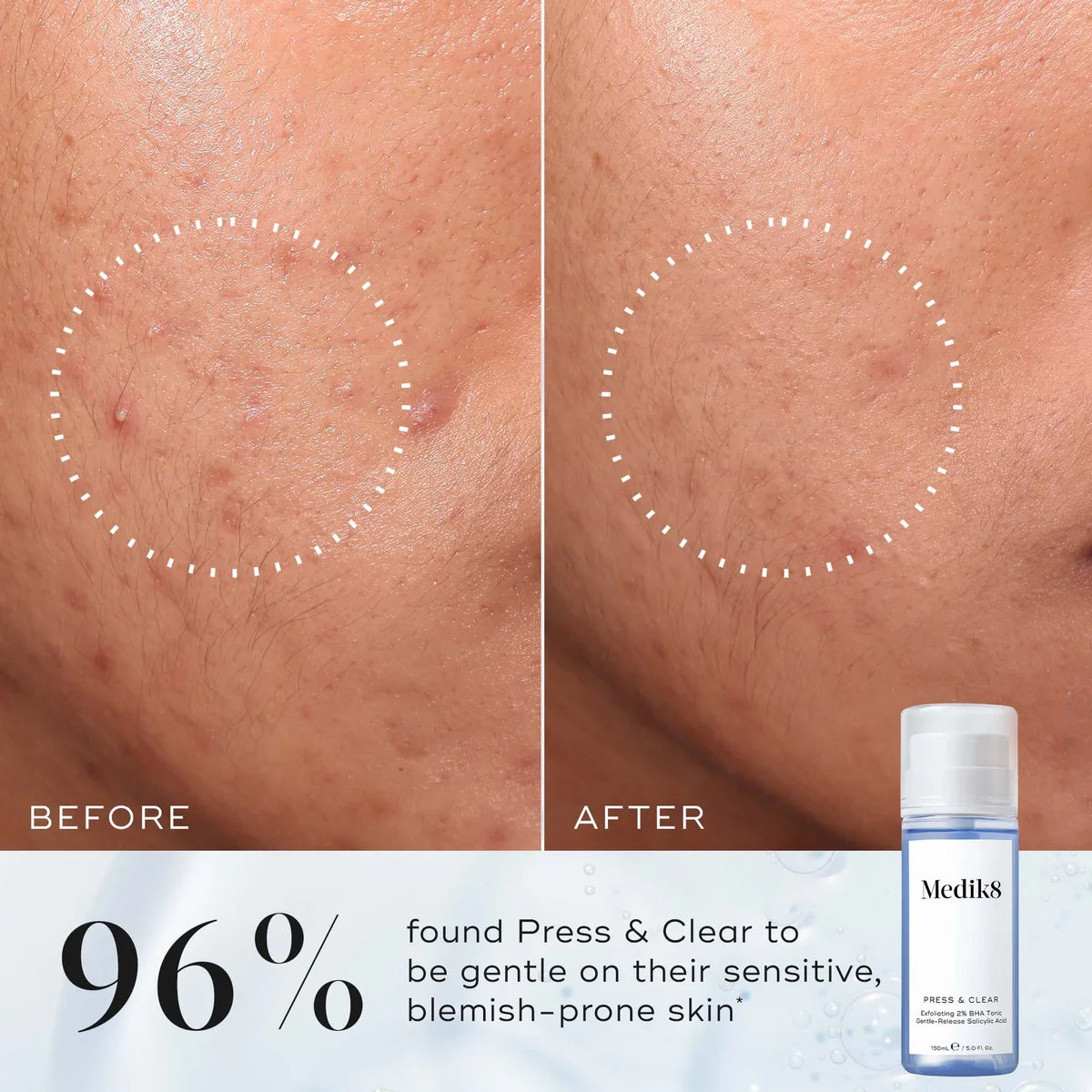 Medik8 Press and Clear 150ml