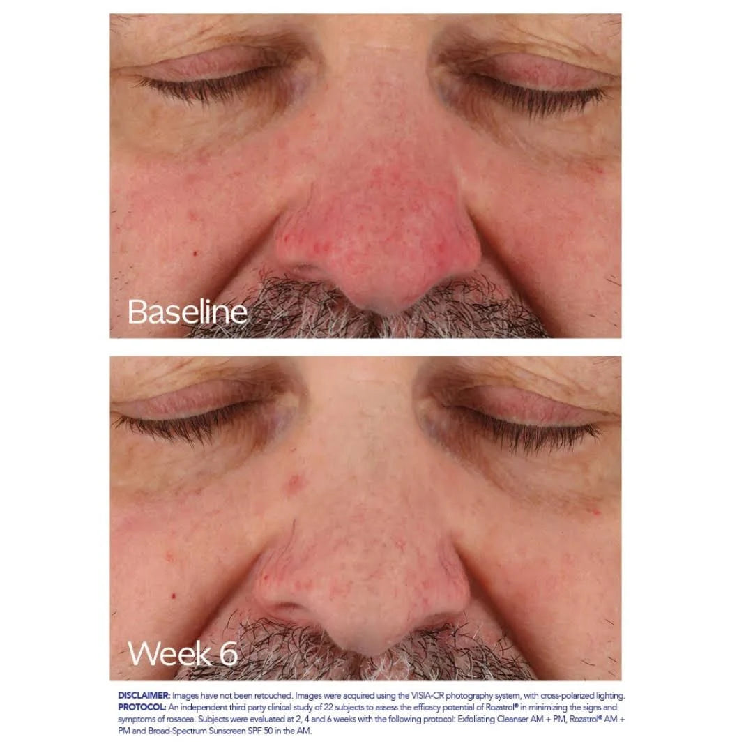 ZO Health Skin Rozatrol®